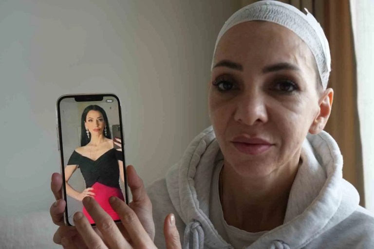 Feci Şekilde Darp Edilmişti, Dehşeti Unutamıyor